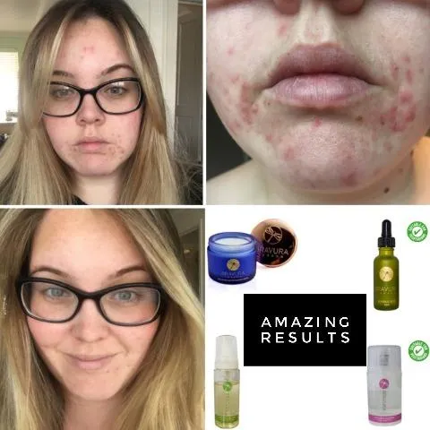 Glycolic Acid 10% Peel with Vitamin B5 30ml