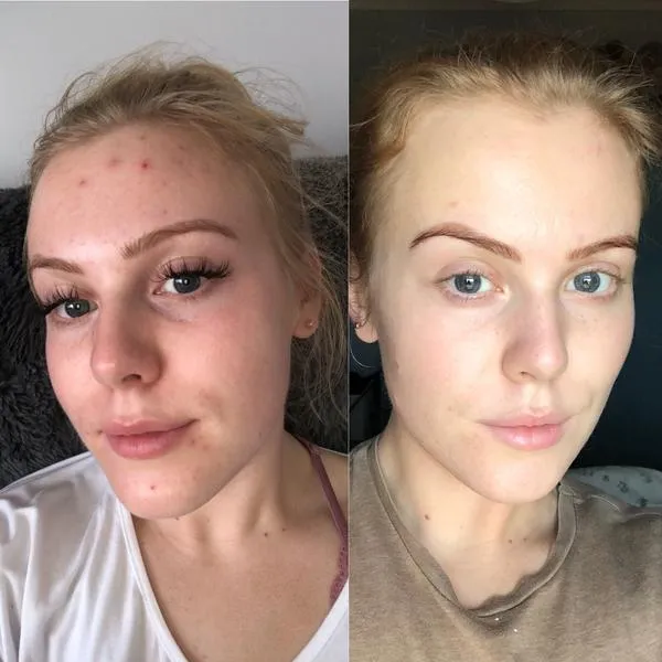 Glycolic Acid 10% Peel with Vitamin B5 30ml